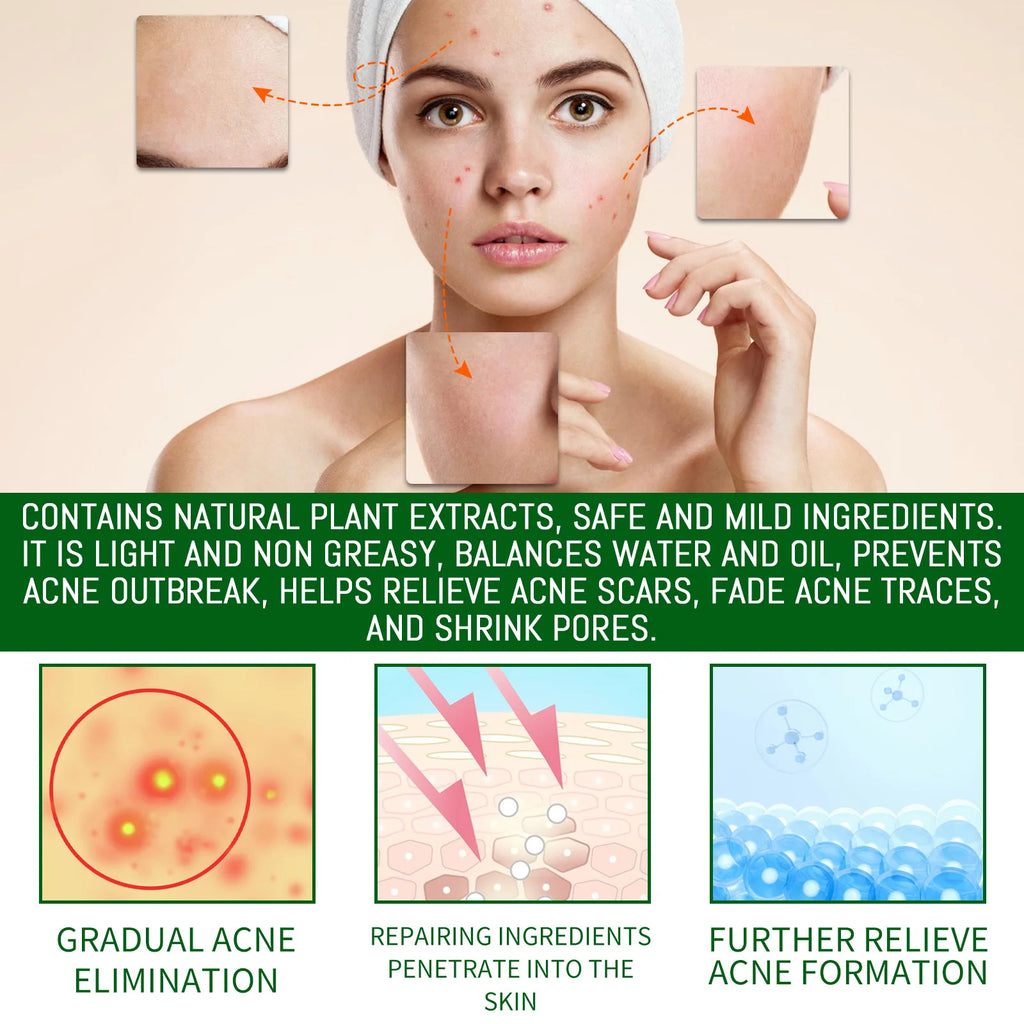 Salicylic Acid Face Serum – Acne, Pores & Oil Control 30ml Anti-Acne Face Serum Zpaxo