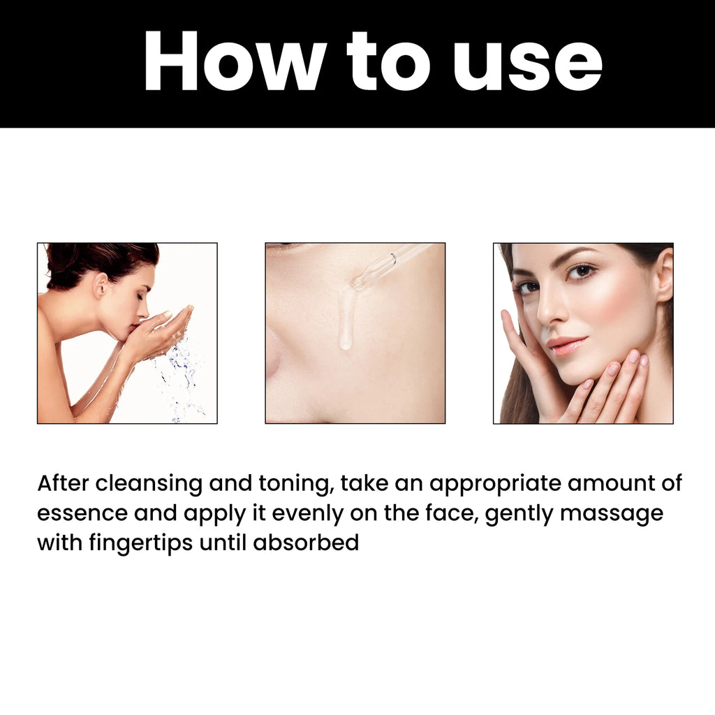 Melanin Correcting Facial Serum Fade Dark Spots Anti Freckle Lightening Pigment Blemish Niacinamide Brightening Face Serum Zpaxo