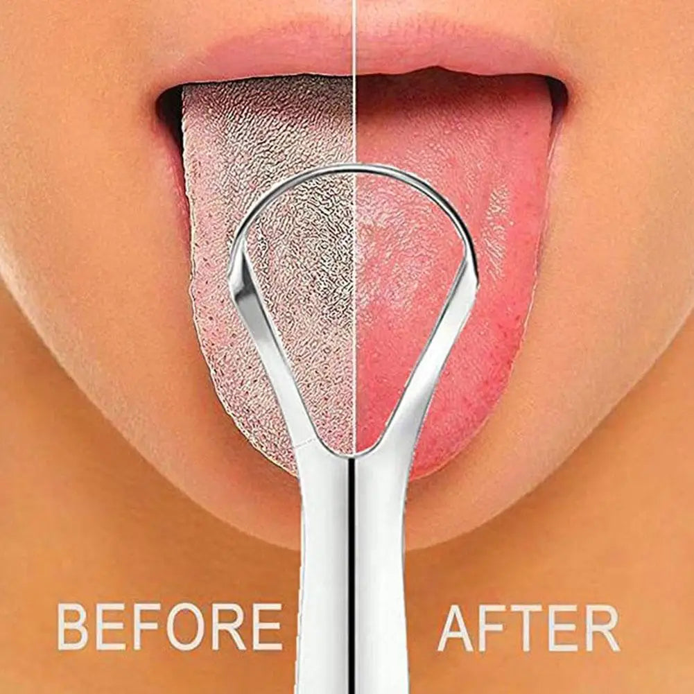 Clean Tongue Scraper Tongue Remover Halitosis Tongue Coating Oral Care Tongue Scraping Brush Stainless Steel Oral Cleaner Tools Zpaxo