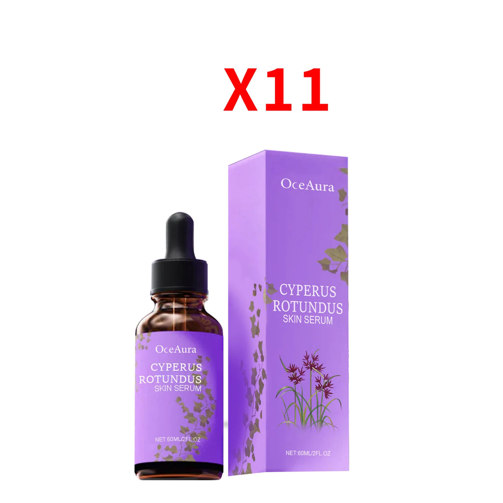 Cyperus Rotundus Hair Growth Inhibitor Serum | OceAura 60ml Hair Growth Inhibitor Serum Zpaxo 660ml boxed