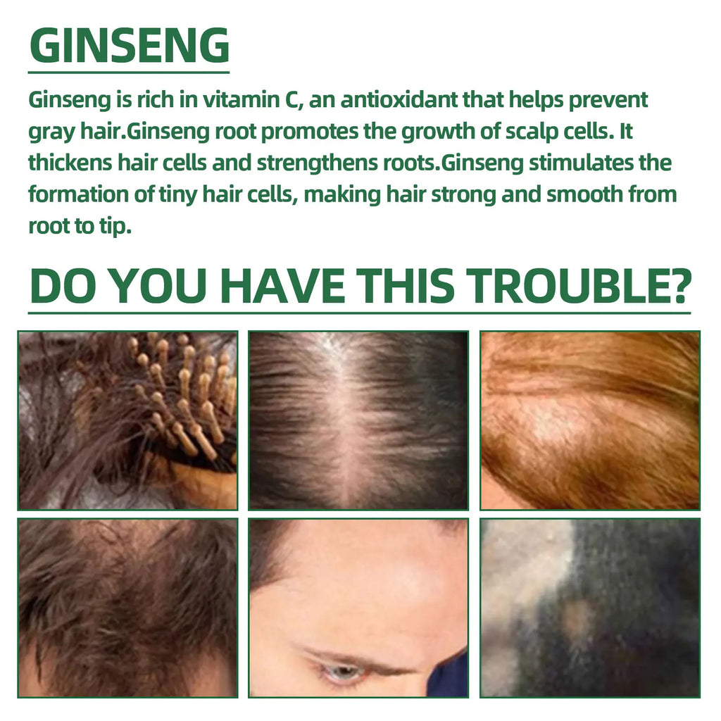 Ouhoe Ginseng Hair Growth Serum 100ml Nourish Scalp Bioactive Formula Promote Hair Regrowth Reduce Hair Fall Strengthen Roots Zpaxo