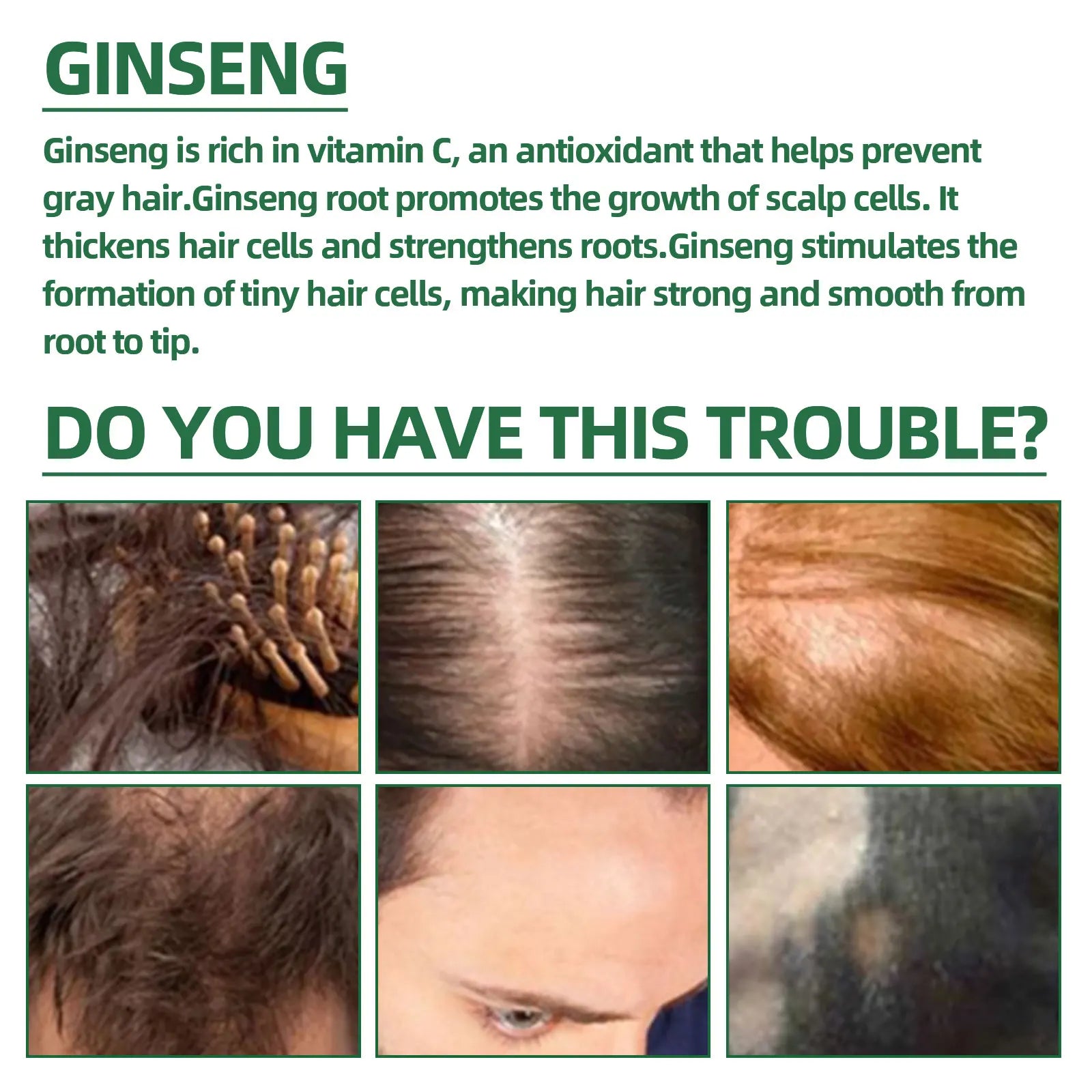 Ouhoe Ginseng Hair Growth Serum 100ml Nourish Scalp Bioactive Formula Promote Hair Regrowth Reduce Hair Fall Strengthen Roots Zpaxo