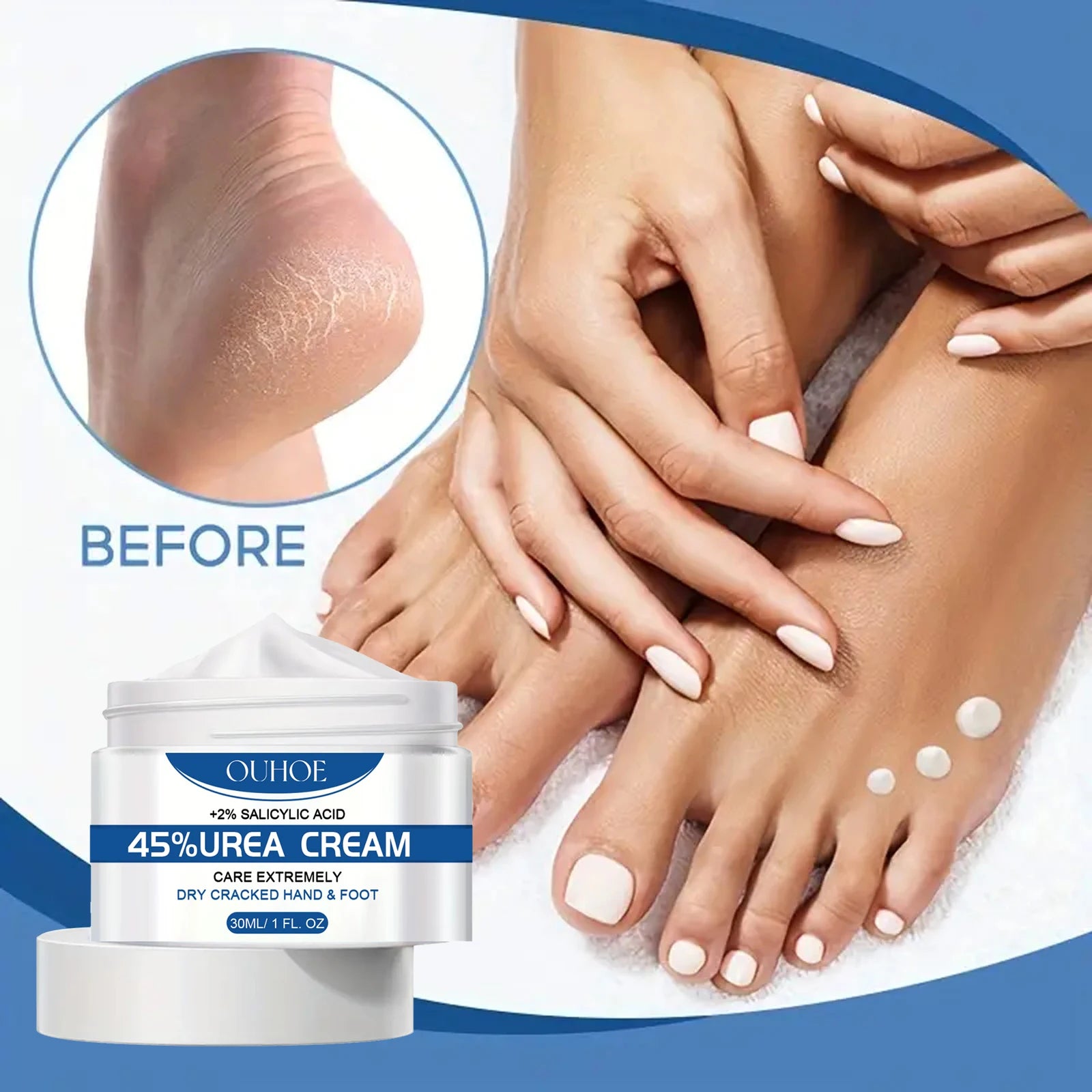 Intensive Foot Hand Cream Dry Cracked Skin Deep Moisture Repair Zpaxo