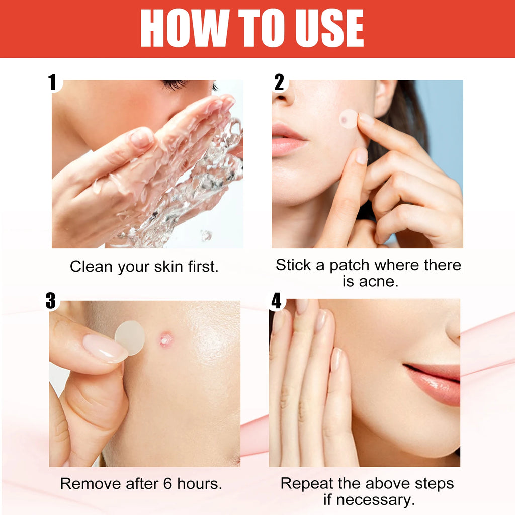 Hydrocolloid Acne Patches 2 Sizes Invisible Makeup-Friendly Pore Care Acne Pimple Patch Breathable for Comedones Treatment Zpaxo