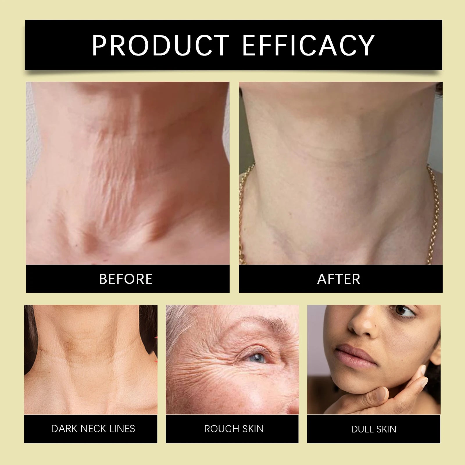Hoygi Bee Venom Firming Serum Stick Anti Wrinkle Cream Lifts Tightens the Skin Solving Wrinkles Fine Lines Natural Serum Zpaxo