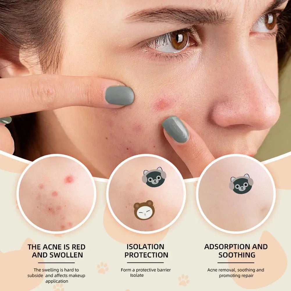 220-Piece Cute Cat Hydrocolloid Pimple Patches | Acne Spot Treatment Acne Pimple Patches Zpaxo