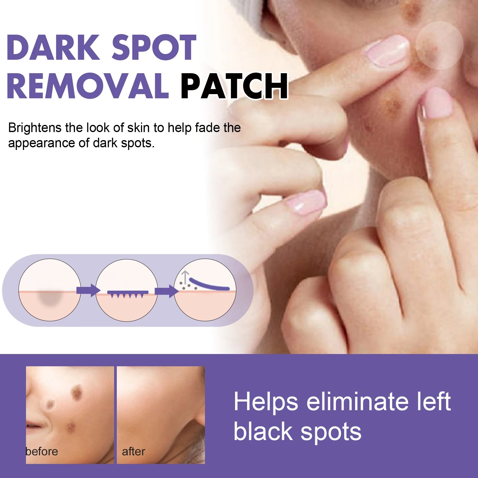 144Pcs EELHOE Hydrocolloid Face Removal Patch Niacinamide Vitamin C Smooth Skins Improve Cleansing Brightening Skin Shrink Zpaxo