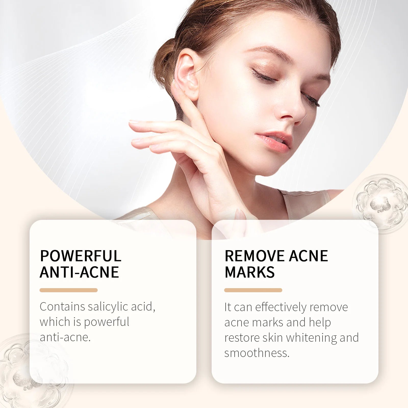 Calendula Anti-Acne Cream – Oil Control, Fade Marks & Pores Acne Face Cream Zpaxo
