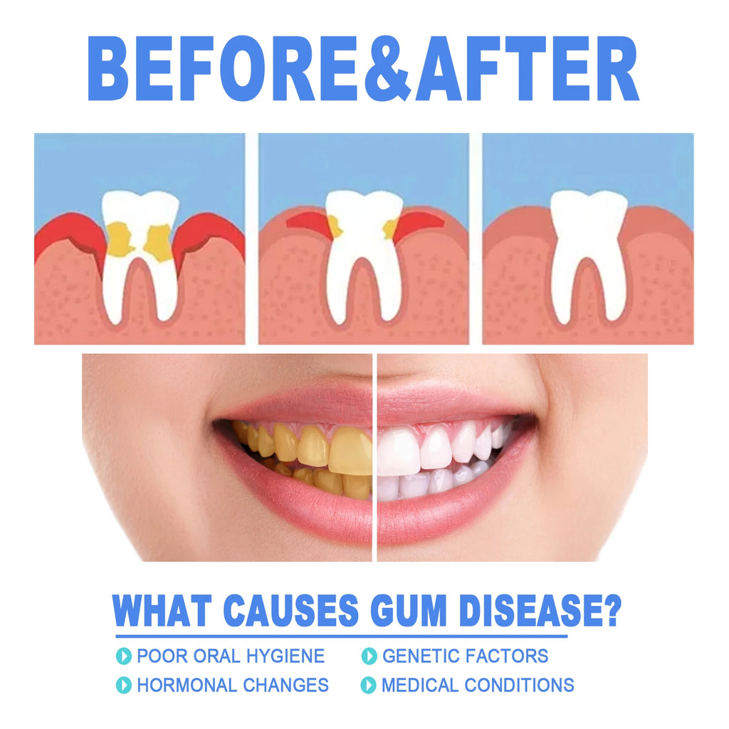 EELHOE Gum Protect Repair Gels Gently Apply Penetrate Quickly Mild Non-Irritating Small Portable Suitable For Every Teeth Type Zpaxo