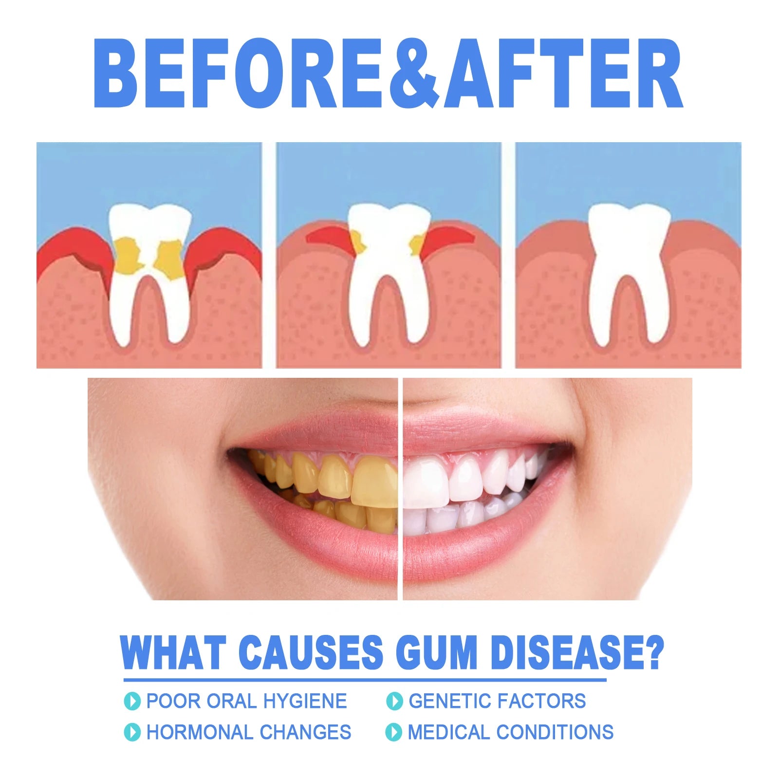 EELHOE Gum Protect Repair Gels Gently Apply Penetrate Quickly Mild Non-Irritating Small Portable Suitable For Every Teeth Type Zpaxo