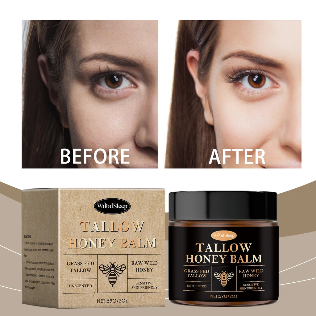 Tallow Honey Balm For Extremely Dry Skin Deep Moisturizing Nourishing Lightweight Fast Absorbing Face Hand Body Daily Care Zpaxo