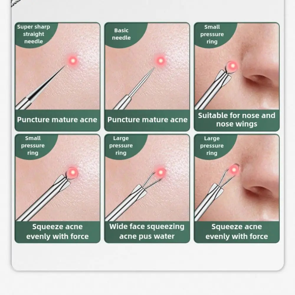 Premium Curved Acne Needle Stainless Face Skin Care Blackhead Tweezers Kit Professional High Hard Blackhead Remover Zpaxo