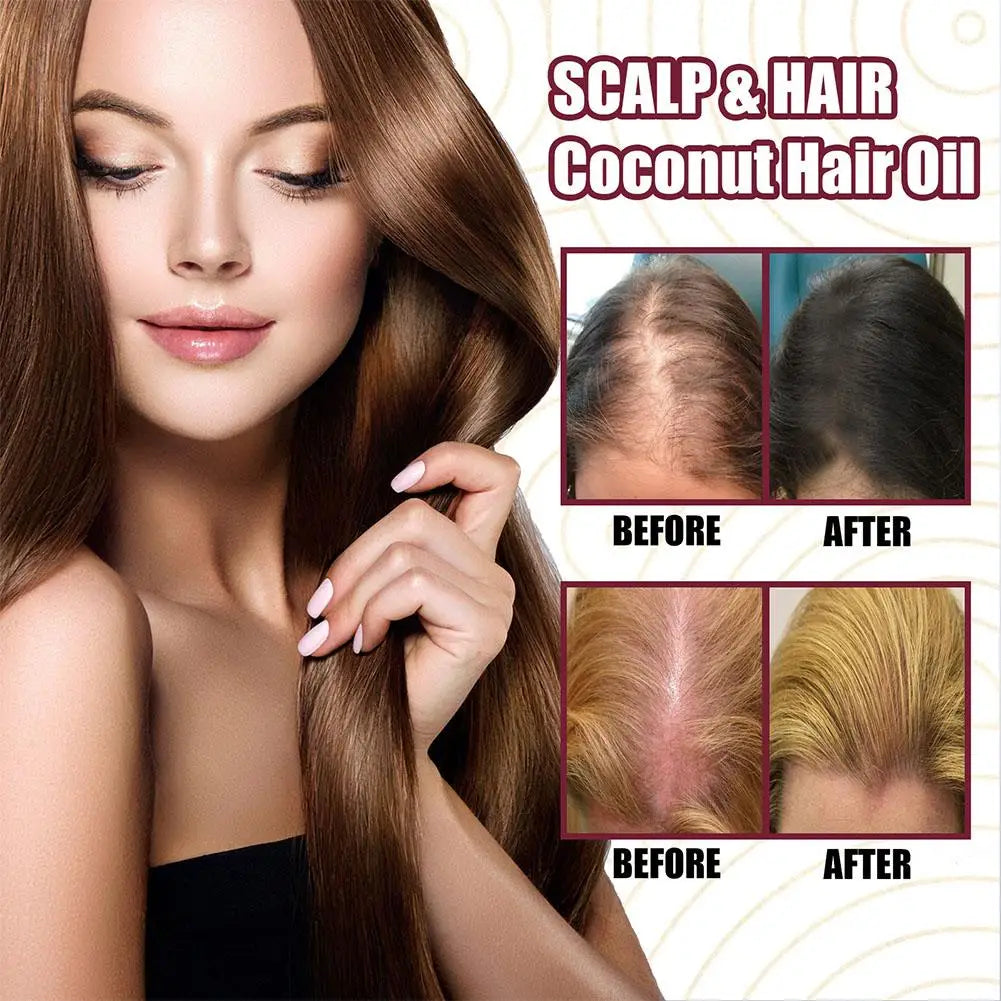 1/2/3pcs Red Onion Hair Care Essential Oil Hair Care Spray Nourish Hair Roots Improve Hair Texture Hair Care Zpaxo