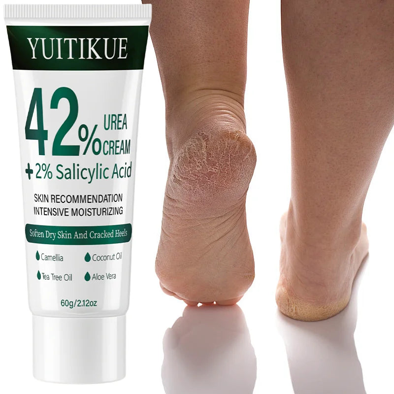 YUITIKUE 42% Urea Cream – Cuticle Softener & Dry Skin Relief 60g Urea Foot Cream Zpaxo
