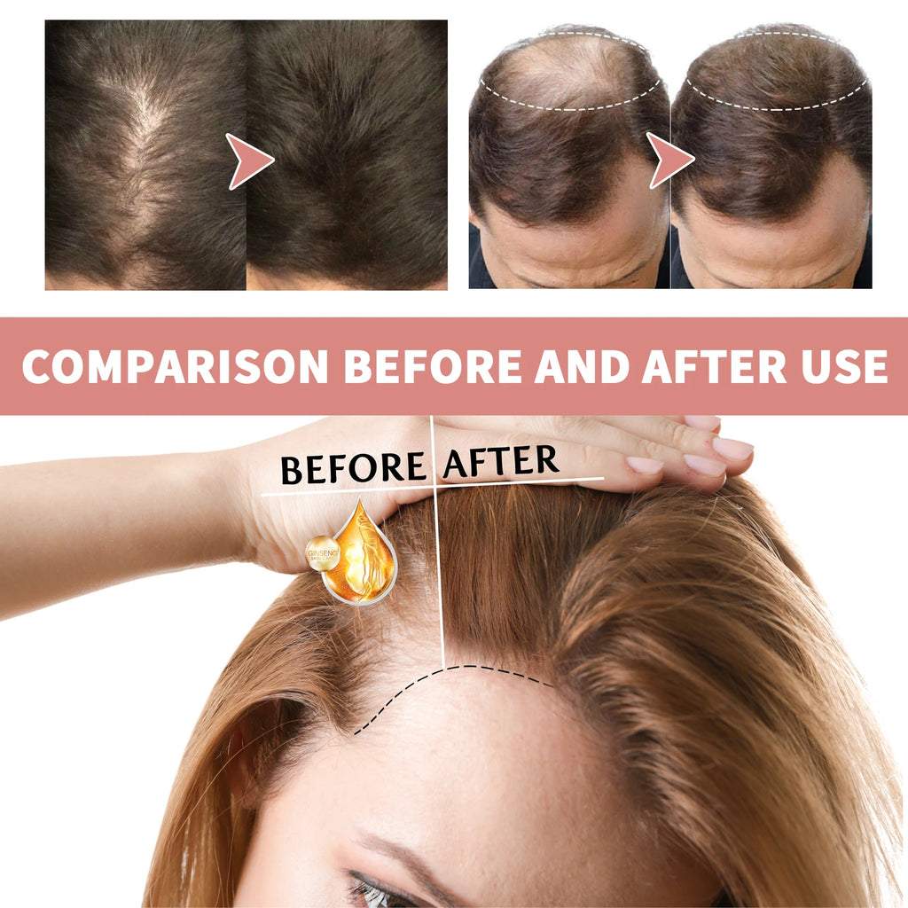 Hair Growth Ampoules Regrowth Anti Hair Loss Repair Split End Dry Damaged Hair Essential Oil Nourishing Scalp Portable Hair Care Zpaxo