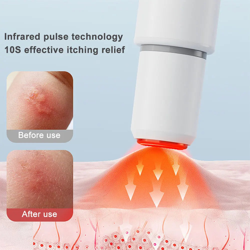 Potable Anti-itch Pen Electronic Mosquito Bite Natural Brepellent