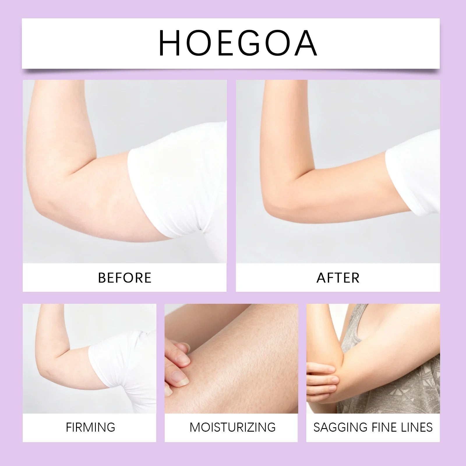 Bee Venom Arm Firming Cream Tightening Moisturizer for Loose Skin Anti-Aging Hydrating Cream with Royal Jelly Winter Body Care Zpaxo