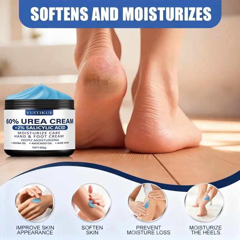 YUITIKUE 60% Urea Foot Cream – Dry Heels & Rough Skin 60g Urea Foot Cream Zpaxo