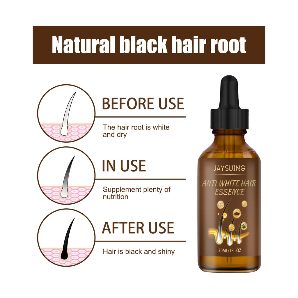 Jaysuing Anti-Grey Hair Serum – Nourishing Essence Oil 30ml Hair Care Serum Zpaxo