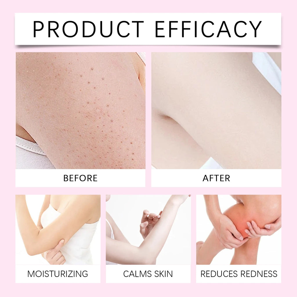 Natural After Hair Removal Care Barrier Protection Stabilizing Restoring Body Oil Soothing Sensitive Moisturizing Sweet Almond Zpaxo