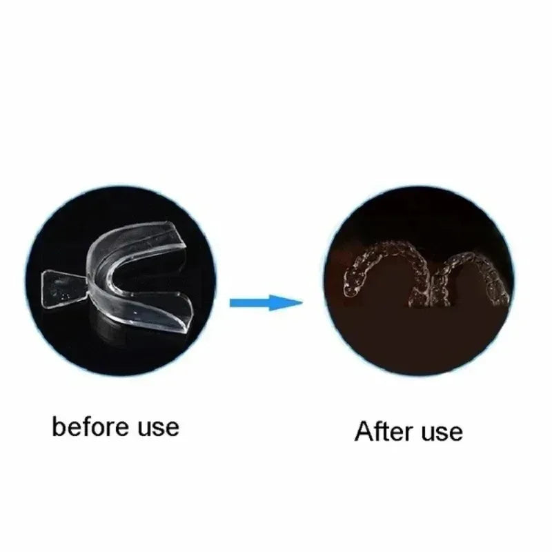 Custom-Fit Night Guard Mouth Tray – Stop Teeth Grinding
