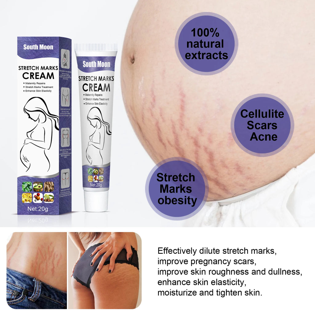 South Moon Stretch Mark Cream – Fade & Firm Skin | 20g Stretch Mark Cream Zpaxo