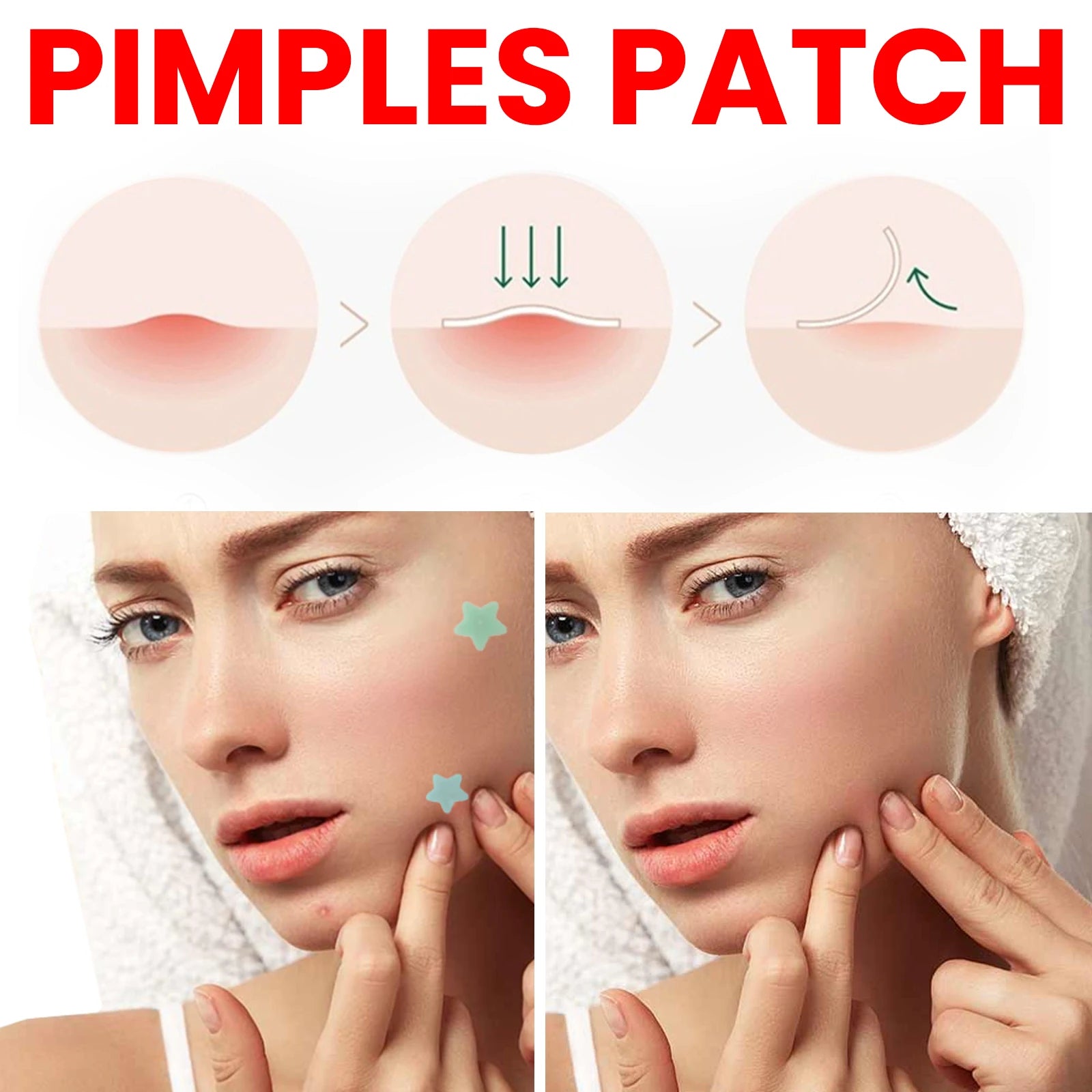 200Pcs Hydrocolloid Star Acne Patches – Fade Pimple Blemishes Acne Pimple Patch Zpaxo