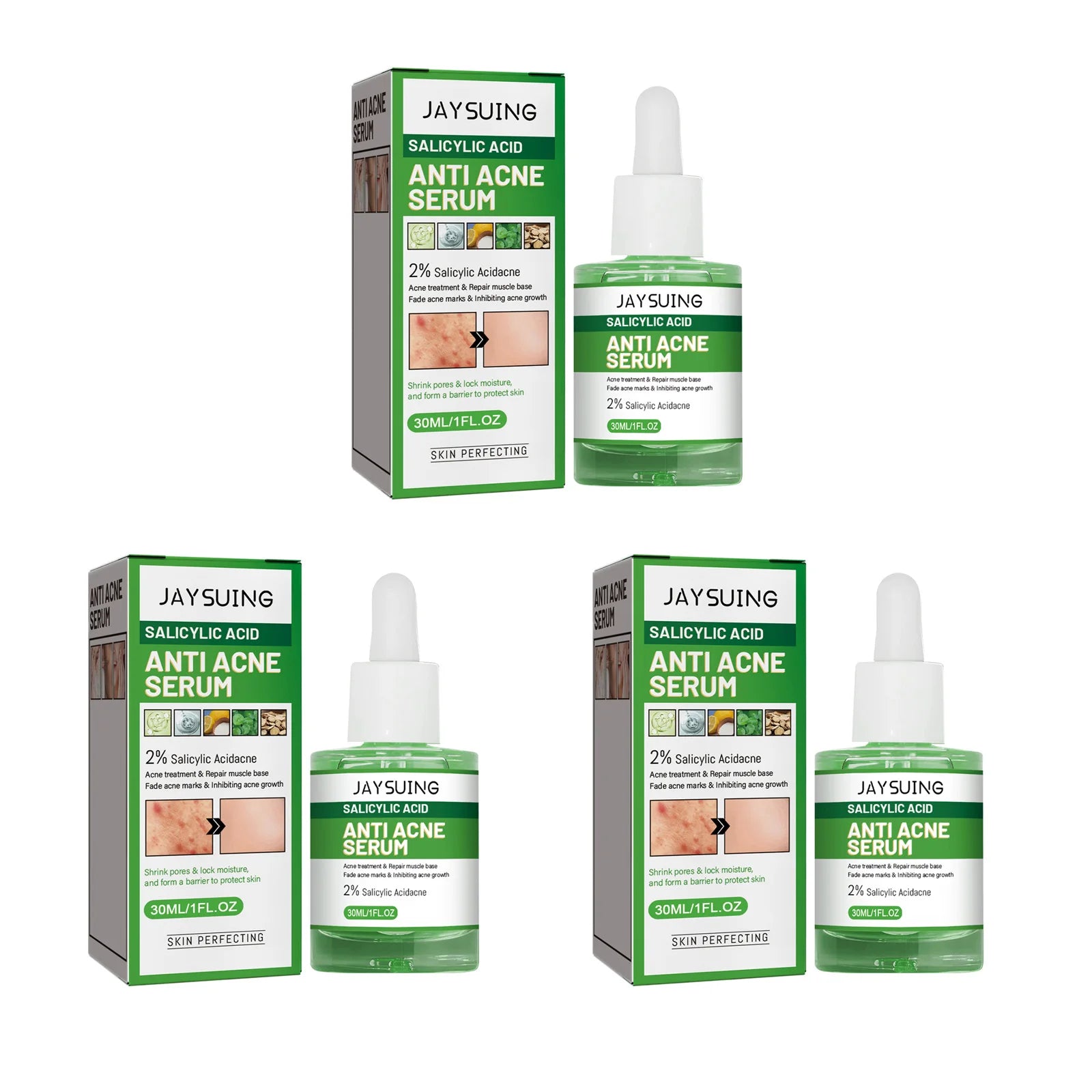 Salicylic Acid Face Serum – Acne, Pores & Oil Control 30ml Anti-Acne Face Serum Zpaxo 3 x 30ml Boxed