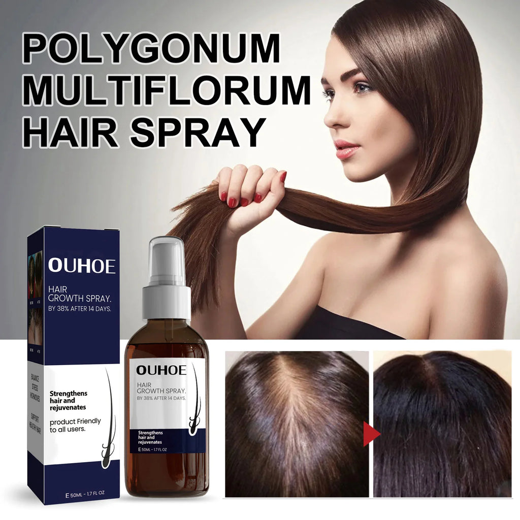 Ouhoe Hair Growth Spray Thinning Strengthen Roots Repair Dry Frizzy Collagen Formula No Residue 50ml Gentle for Sensitive Scalp Zpaxo
