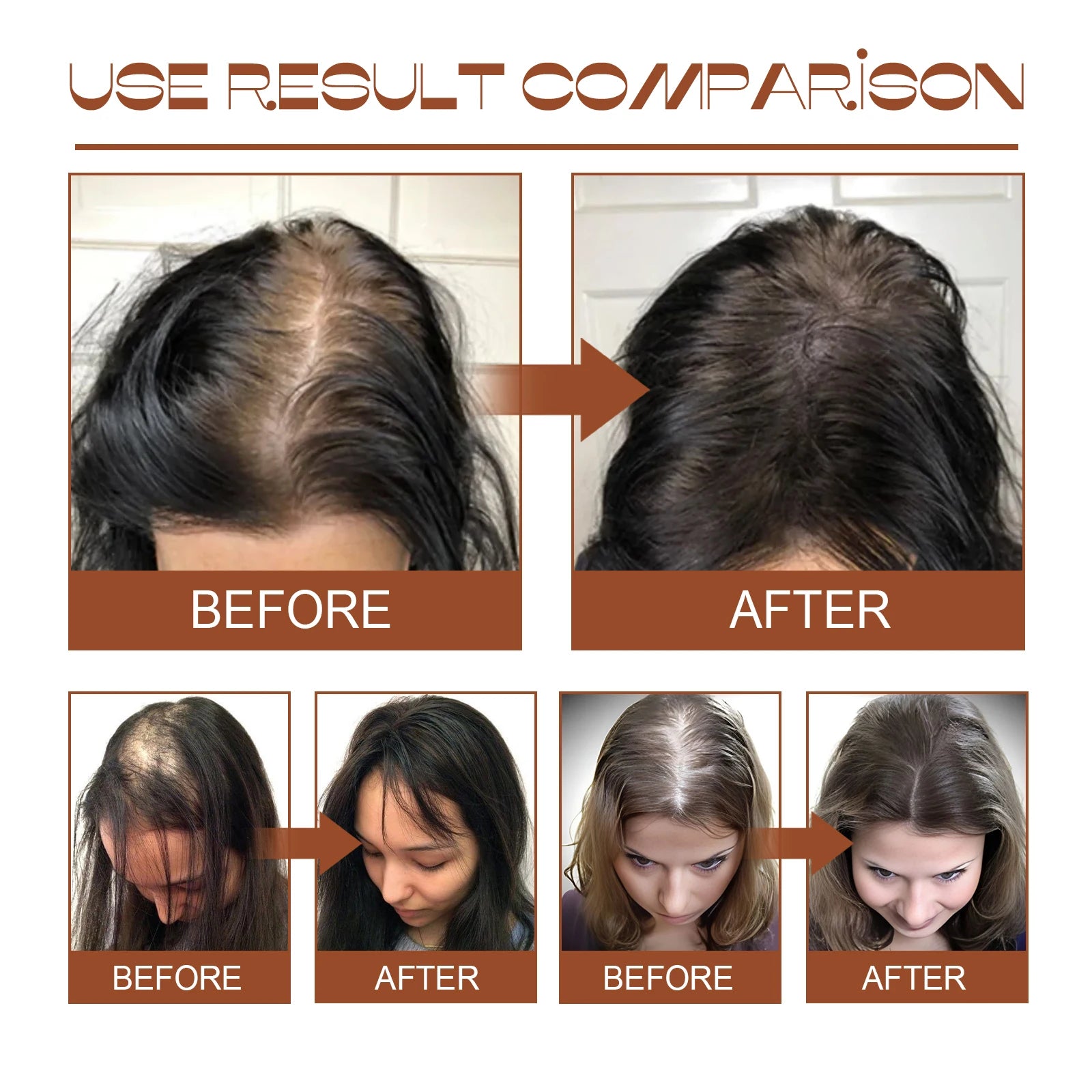100% Natural Unrefined and Organic Batana Oil for Hair Growth & Strength, Prevents Hair Loss Eliminates Split Ends for Men Women Zpaxo