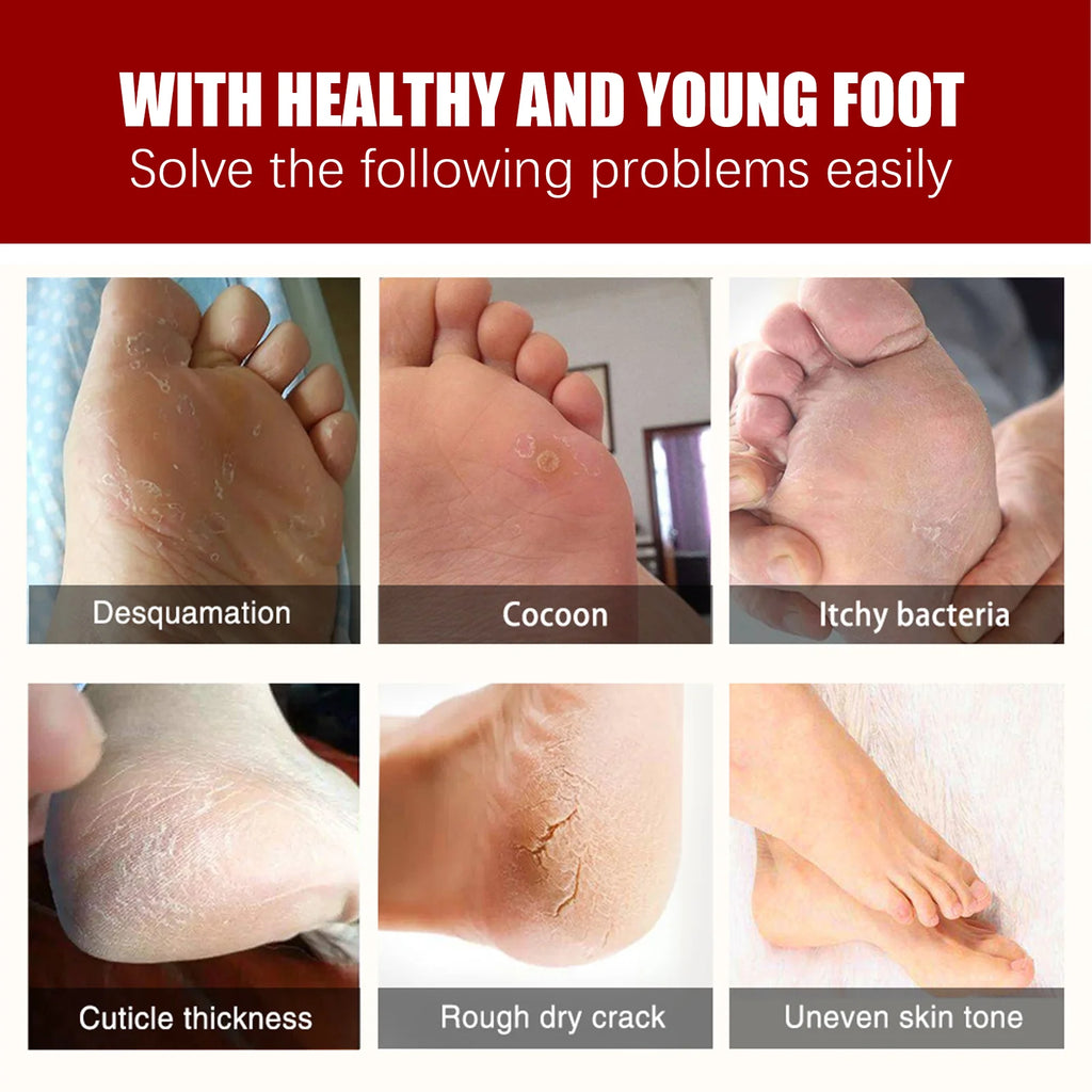 AHA Exfoliating Foot Mask Moisturizing Anti Crack Heel Foot Calluses Dead Skin Remover Smooth & Soft Feet Care Foot Patch Zpaxo