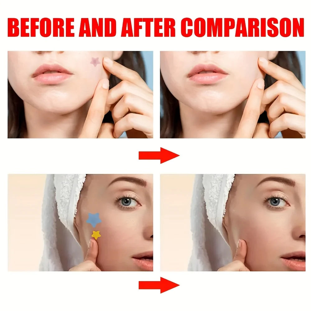 Colorful PE Pimple Patches Cute Star Shaped Cover Sticker Invisible Zpaxo