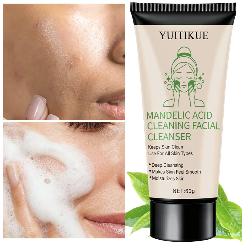 Mandelic Acid Facial Cleanser 60g | Deep Pore & Oil Control Facial Cleanser Zpaxo