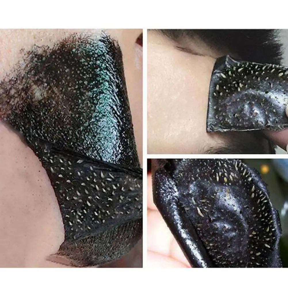 Plant Extraction Blackhead Remover Peel-Off Mask | All Skin Types Blackhead Peel Mask Zpaxo