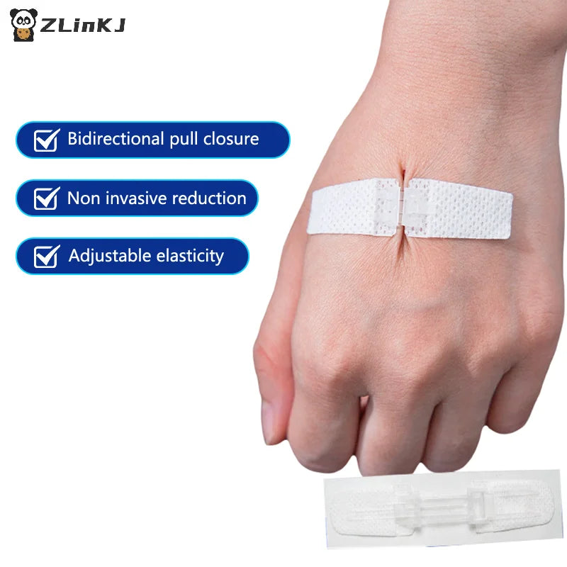 Zipper Band-aid Painless Wound Closure Patch Suture-free Dressing Zpaxo