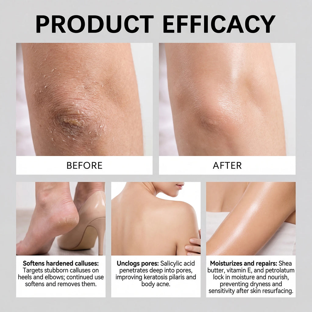 Exfoliating Body Stick Smoothing AHA BHA Shea Butter Moisturizing Skin Softening Body Exfoliator for Dry Skin Dead Skin Remover Zpaxo