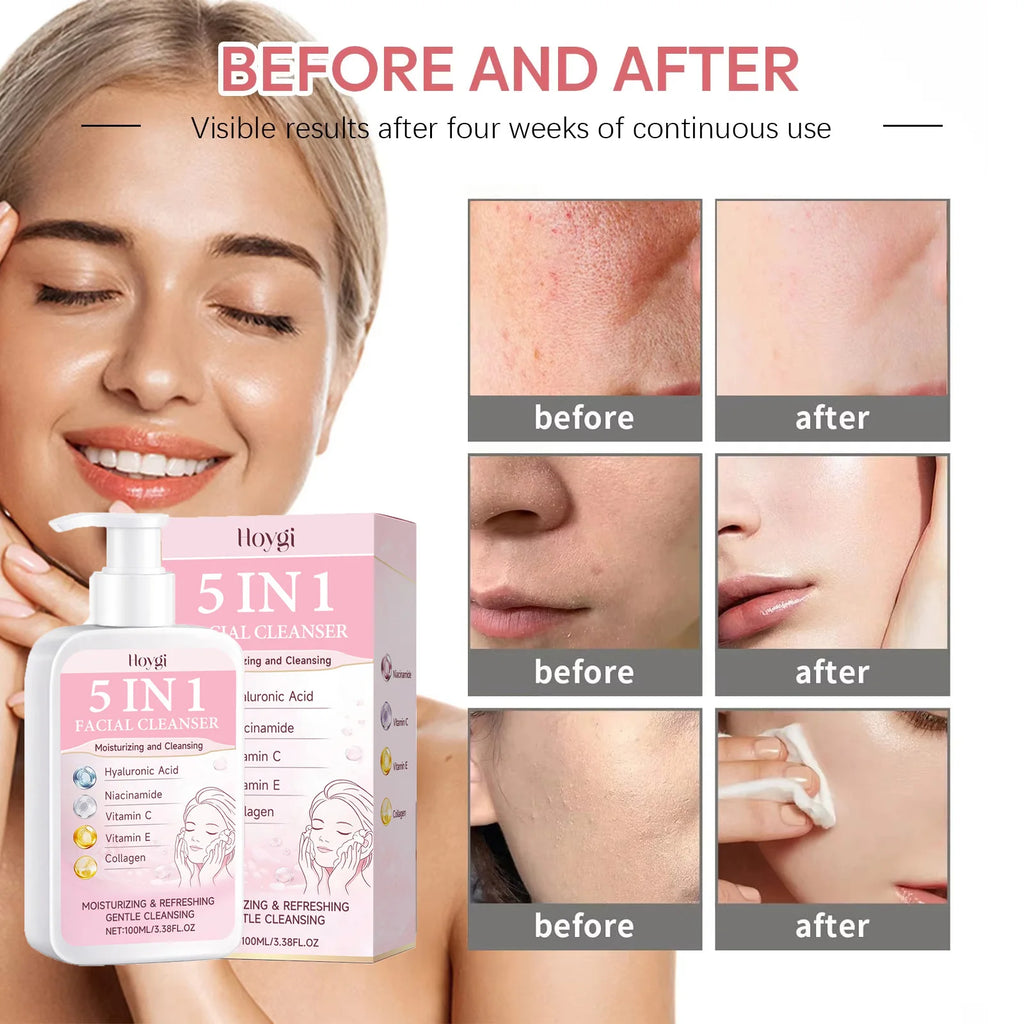Hoygi 5-in-1 Facial Cleanser – Hydrating, Brightening Foam Facial Cleanser Zpaxo