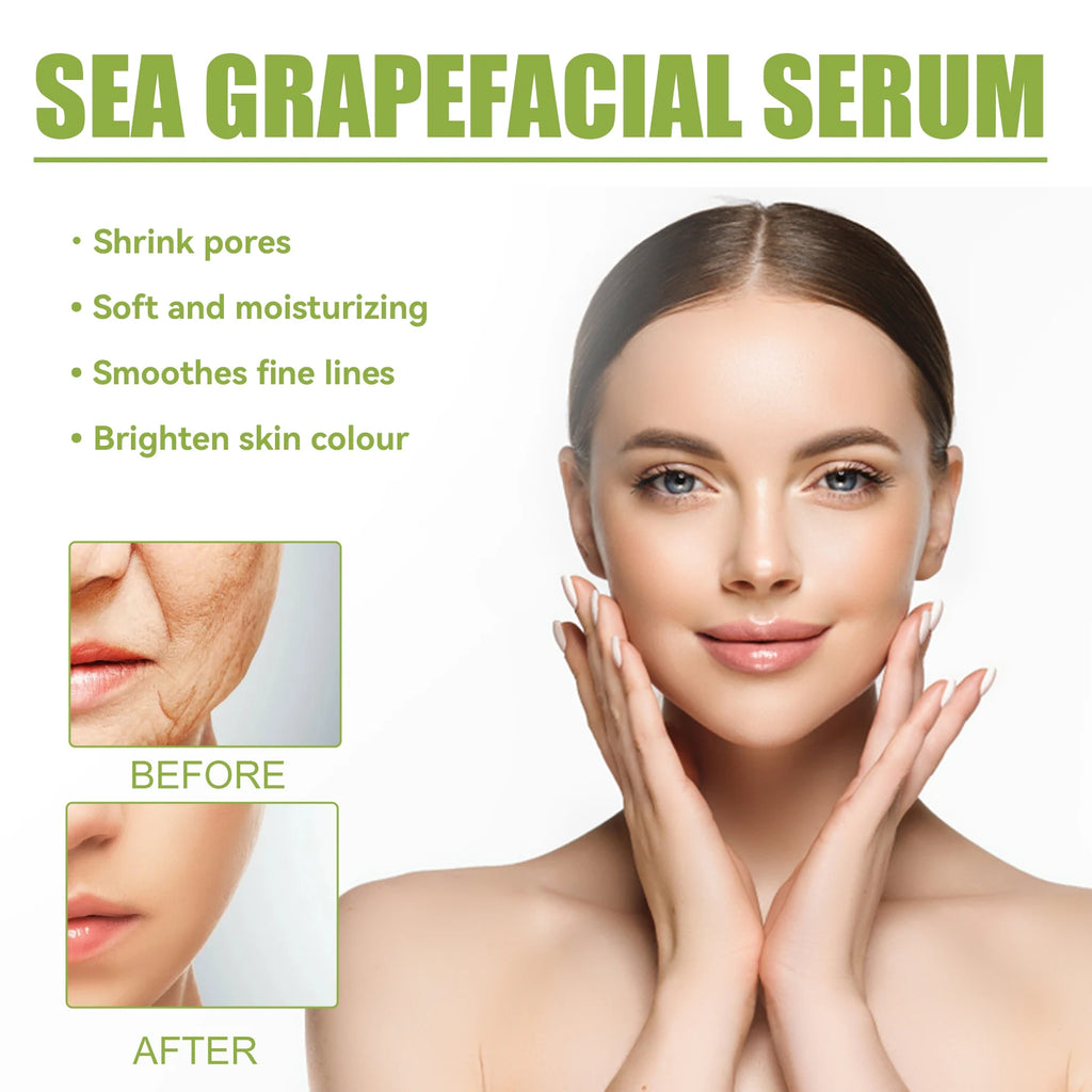 EELHOE Sea Grapes Polypeptide Facial Moisturizing Essence Improve Collagen Antioxidants Deeply Moisturize Your Dry Skin 35ml Zpaxo