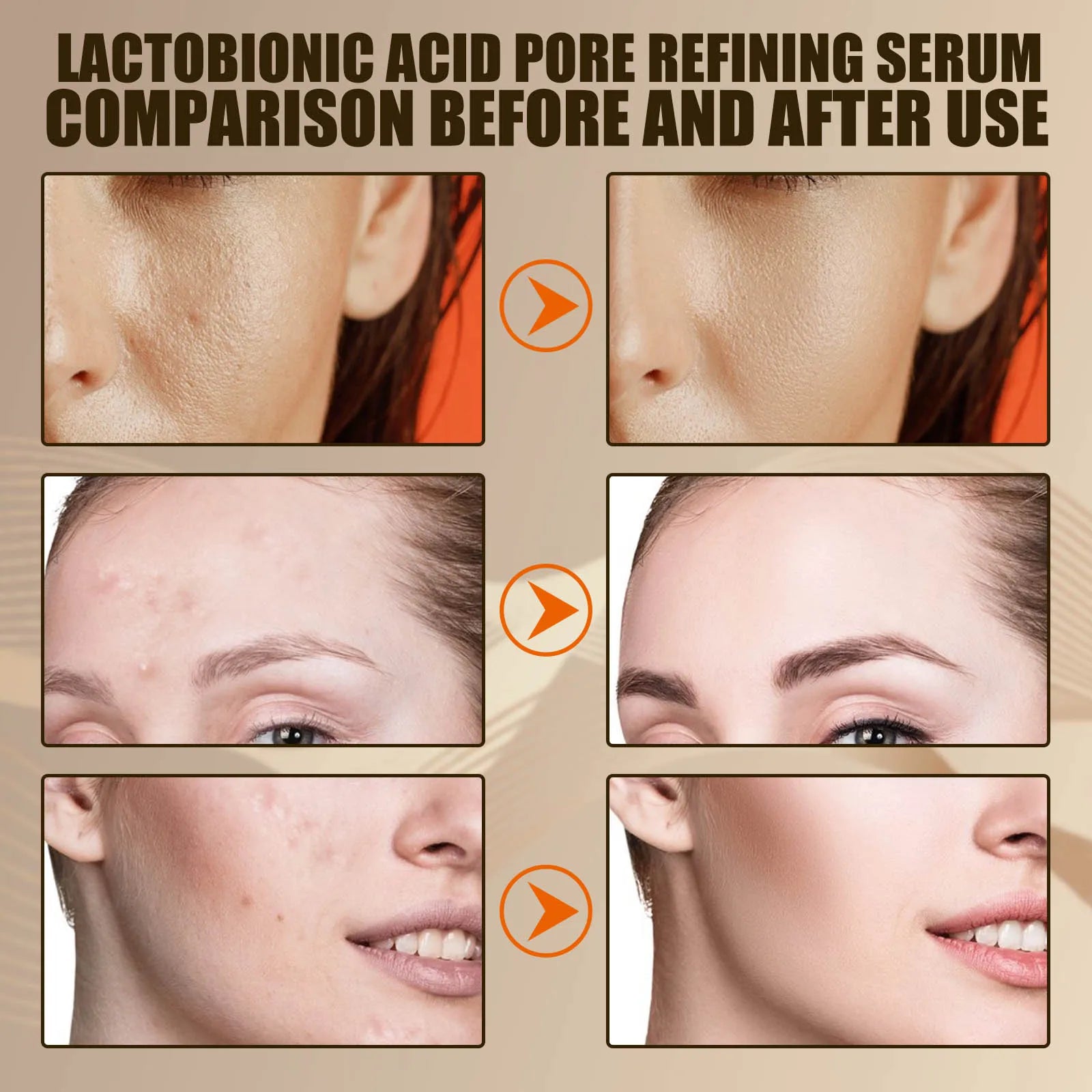 EELHOE Lactobionic Acid Pore Shrink Face Serum Skin Repair Remove Blackheads Acne Skin Care Lasting Moisturizing Korean Cosmetic Zpaxo