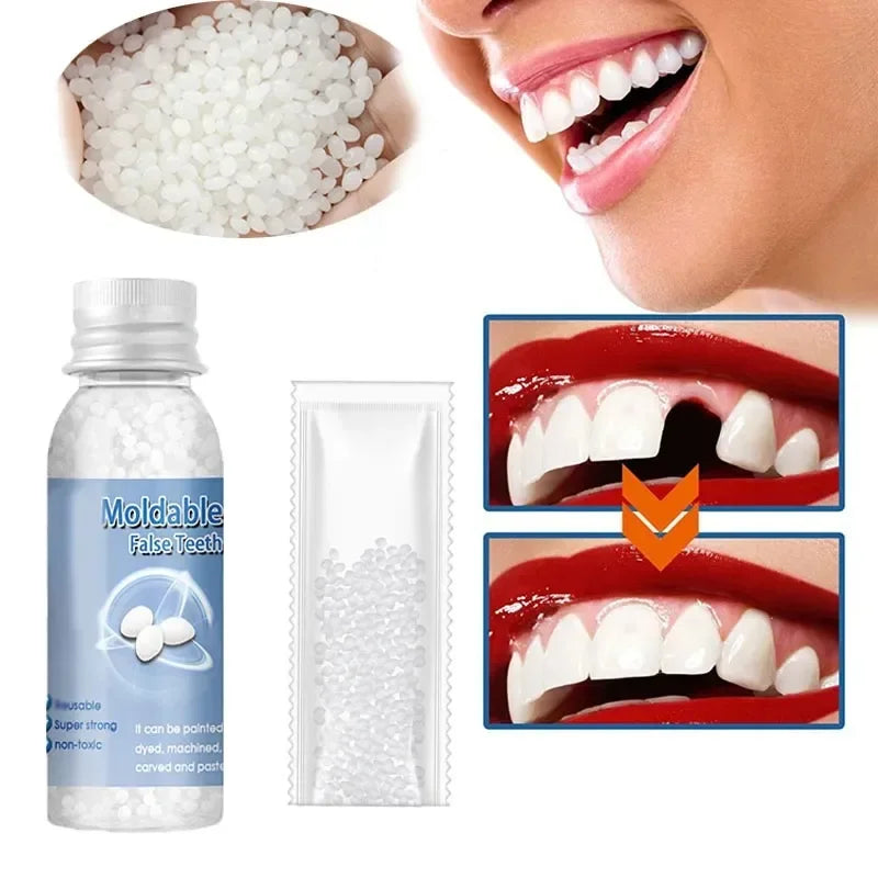Temporary Tooth Repair Kit – Moldable Resin Dental Adhesive