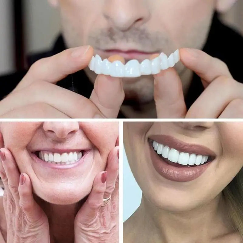 Snap-On Teeth Veneers – Reusable Temporary Smile Veneers Cosmetic Tooth Veneers Zpaxo