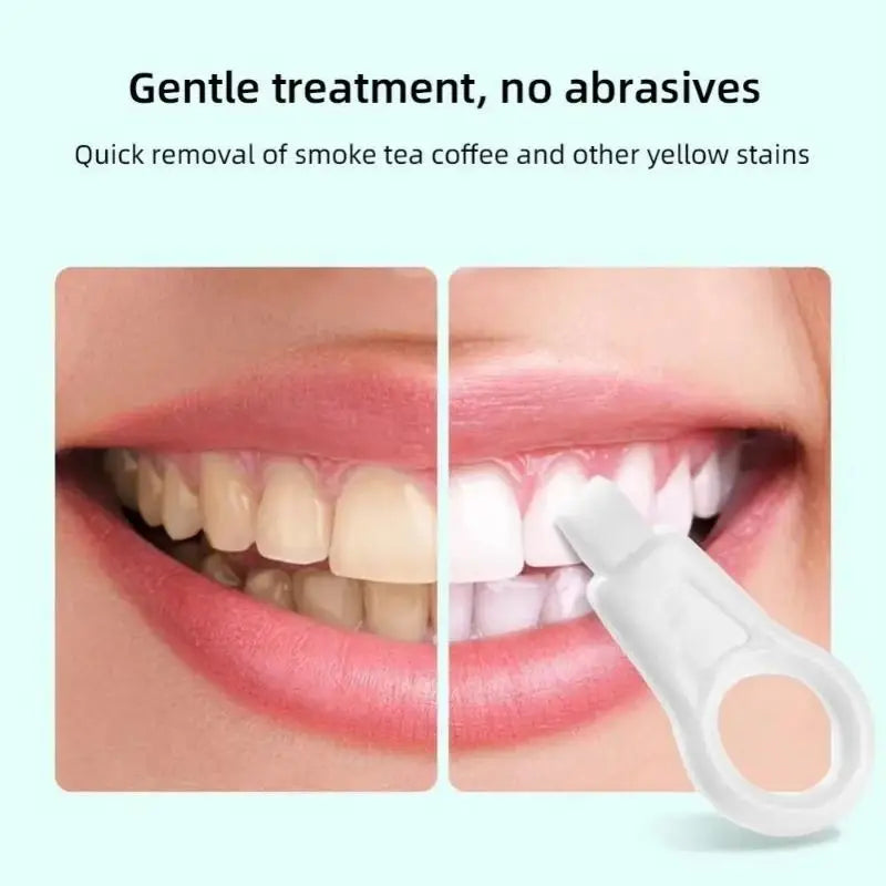 Nano Teeth Cleaning Sponge 3/6-Pack | Stain & Plaque Remover Dental Cleaning Sponge Zpaxo