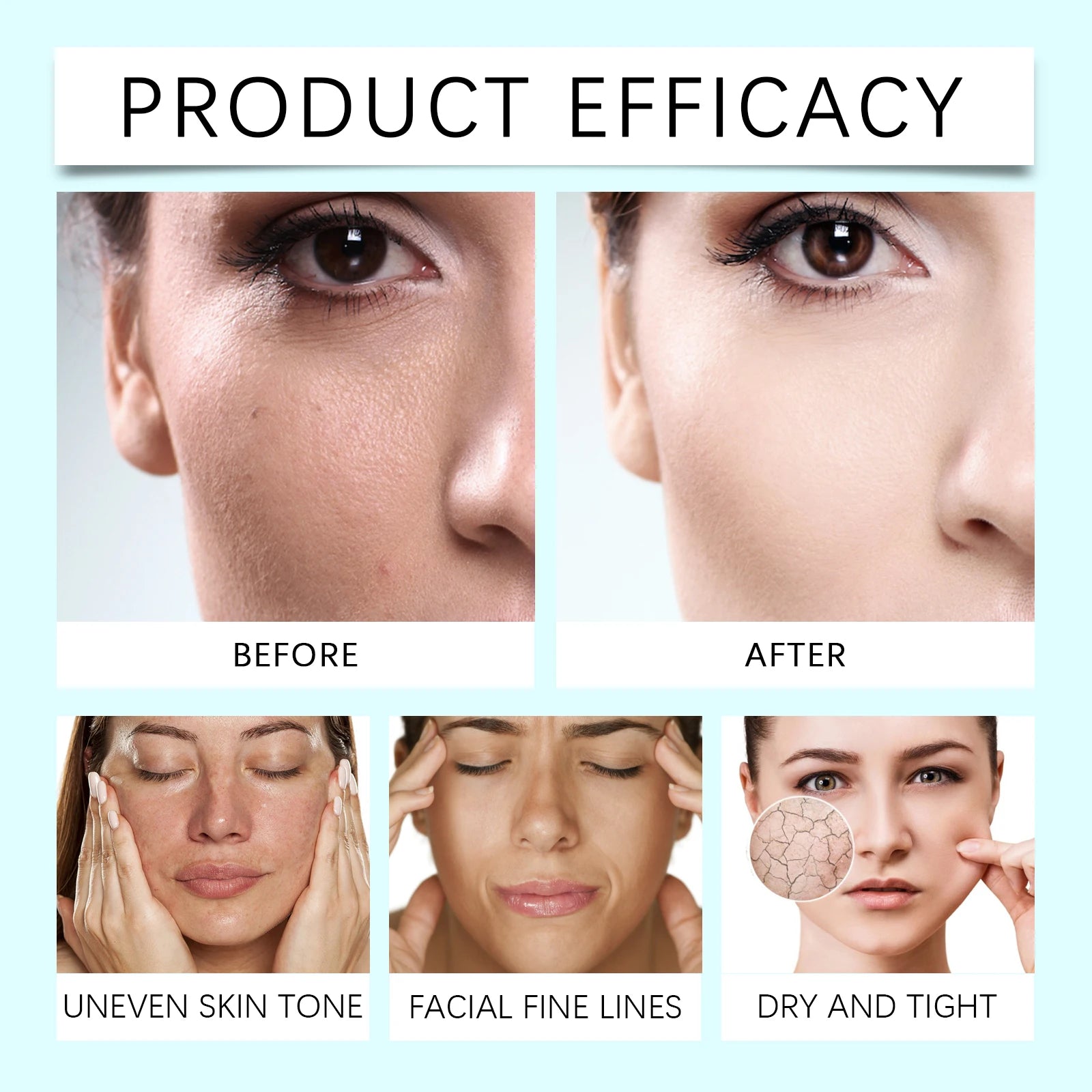 Night Moisturizer Hydrating Cream Dry Skin Vitamin C E Anti-aging Zpaxo