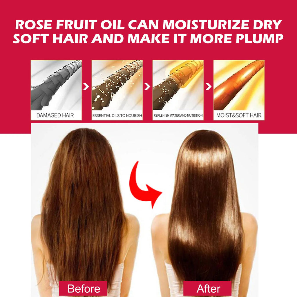 EELHOE Rosehip Facial Oil – Anti-Aging, Firming & Moisturizing Facial Essential Oil Zpaxo