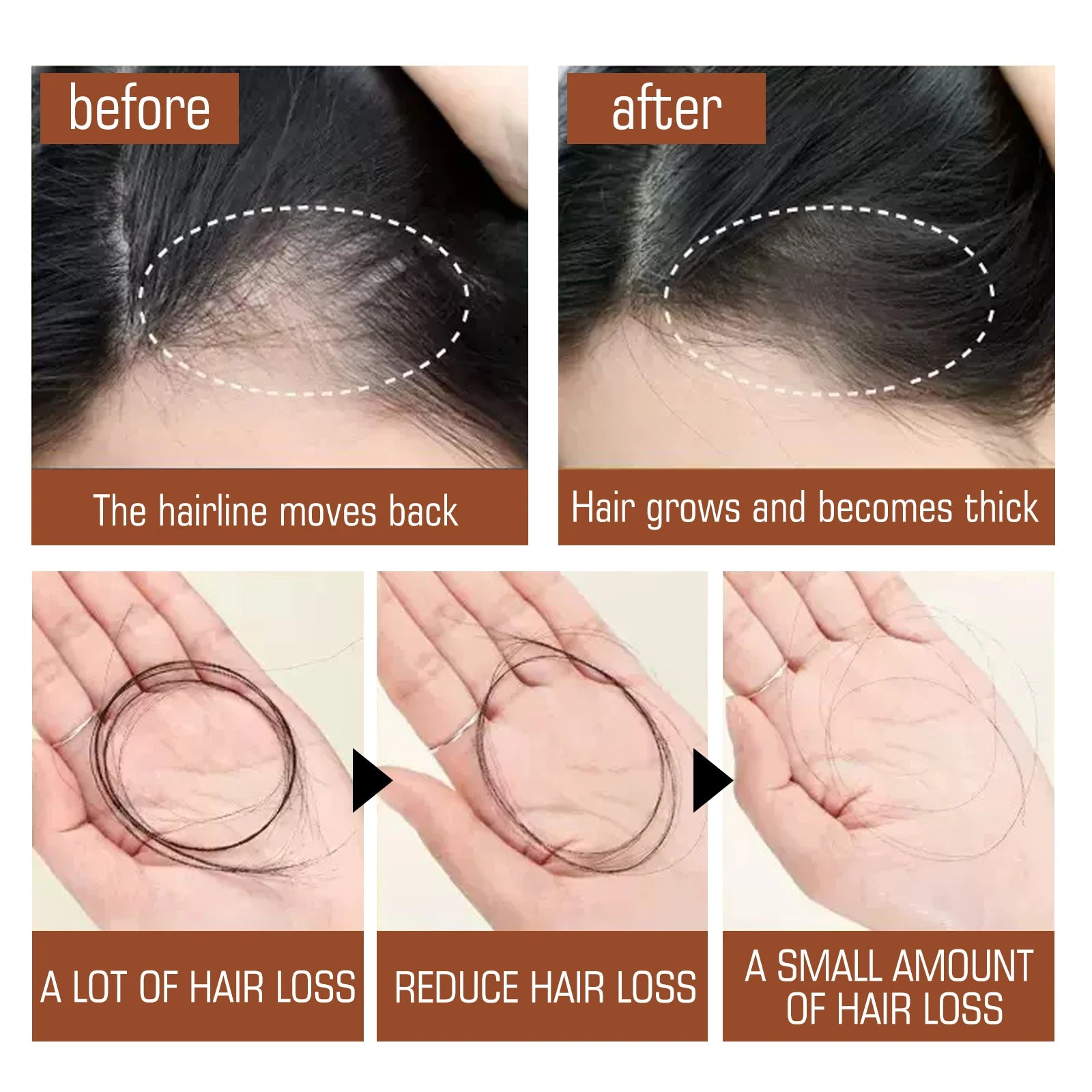 100% Natural Unrefined and Organic Batana Oil for Hair Growth & Strength, Prevents Hair Loss Eliminates Split Ends for Men Women Zpaxo