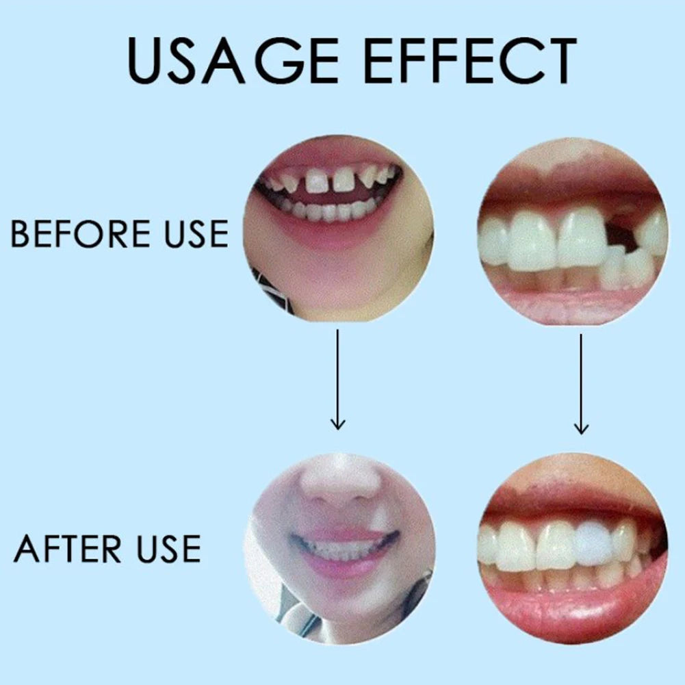 10 DIY Dentures Teether Temporary Solid Cavity Plugging Glue