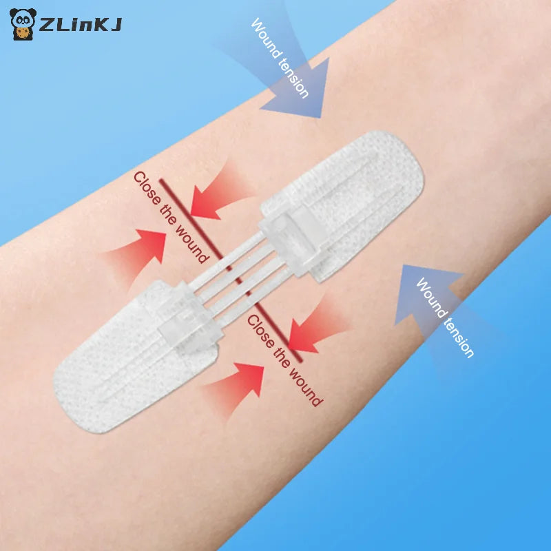 Zipper Band-aid Painless Wound Closure Patch Suture-free Dressing Zpaxo