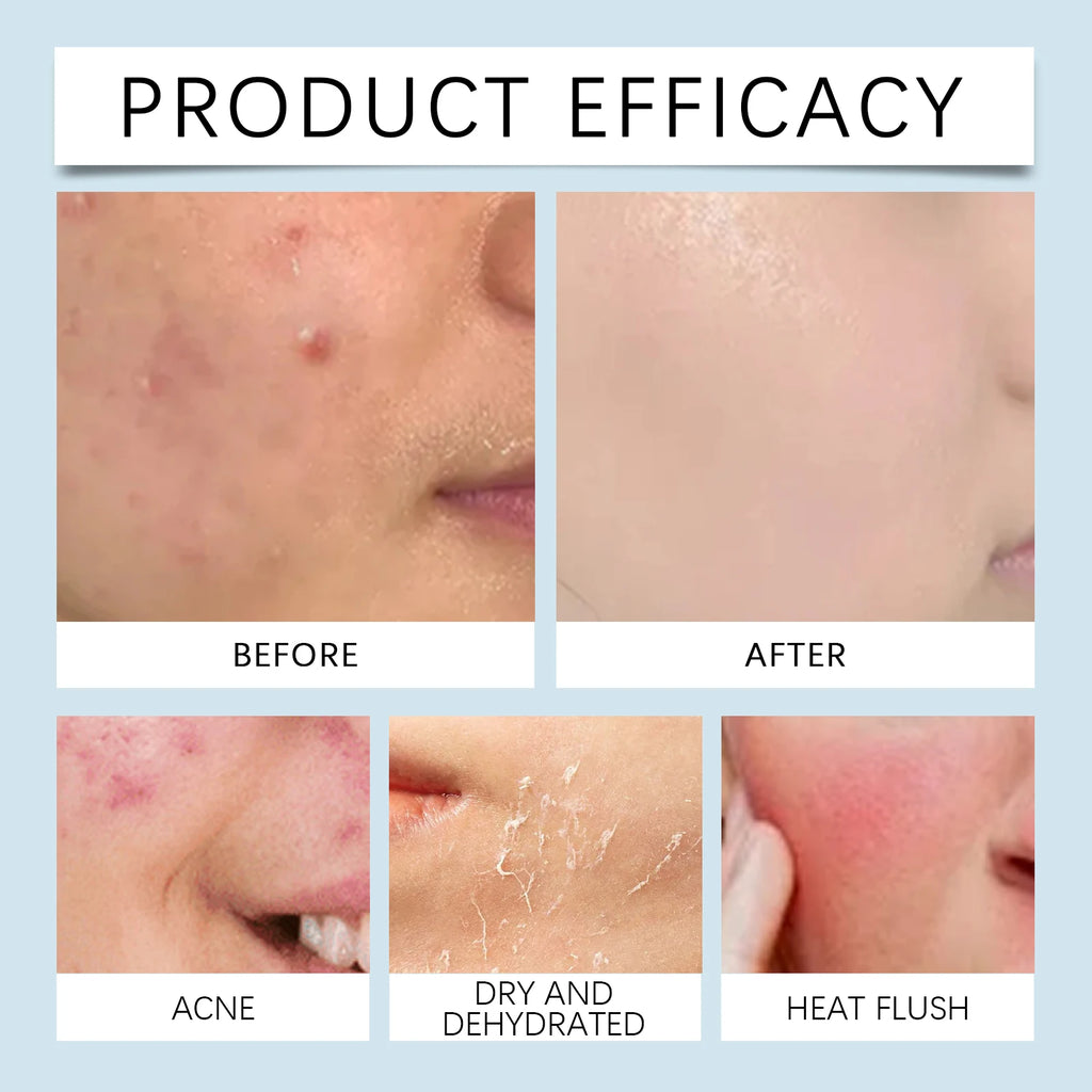 Facial Roller Serum Hydrating Winter Skincare Cold Weather Zpaxo