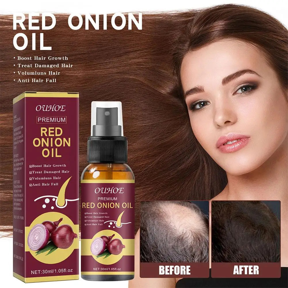 1/2/3pcs Red Onion Hair Care Essential Oil Hair Care Spray Nourish Hair Roots Improve Hair Texture Hair Care Zpaxo