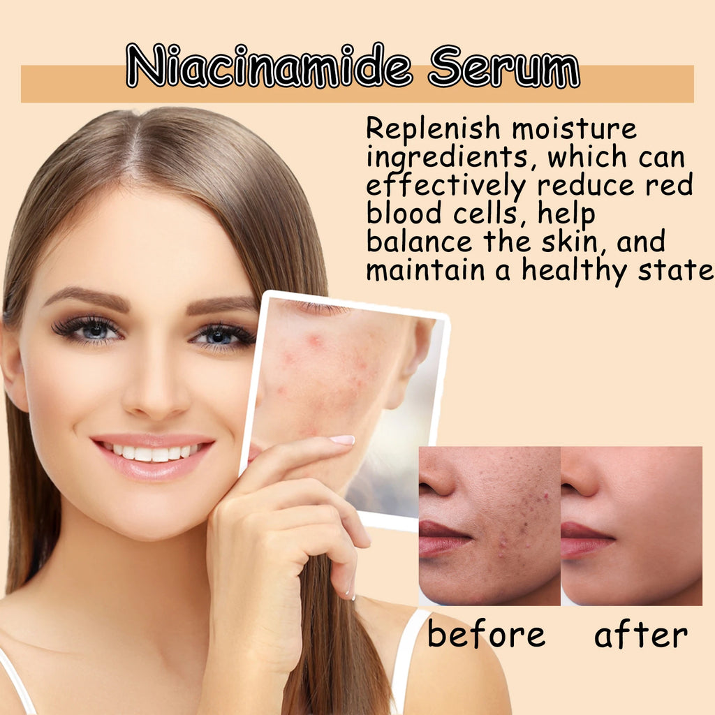 Nicotinamide Face Serum – Brightening & Pore Minimizing 30ml Face Serum Zpaxo